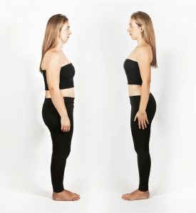 Image to show improved posture, lifted not saggy due to less fluid build up in the body.